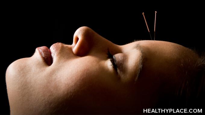 Panel NIH uzatvára účinnosť akupunktúry pri liečbe chronickej bolesti, fibromyalgie a ďalších stavov stále vo vzduchu.